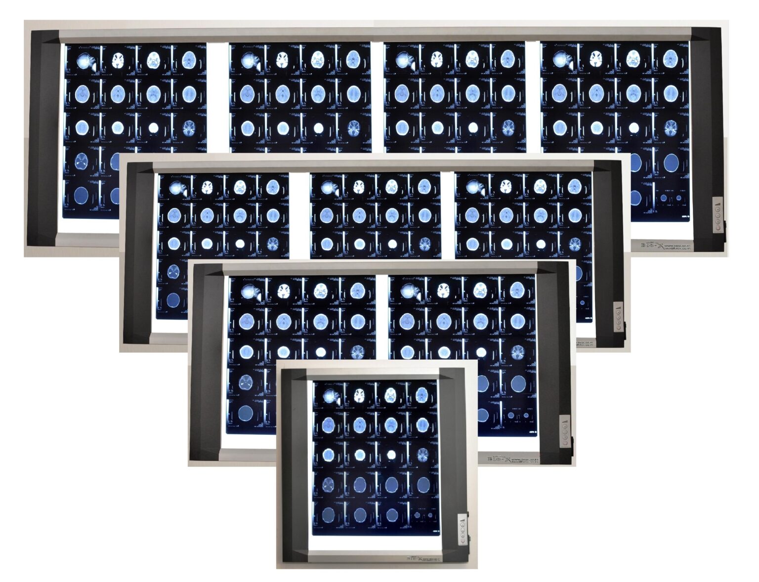 X Rayed Box Core X-ray View Boxes: Single & Multi-Panel | Best Prices | Medikabazaar