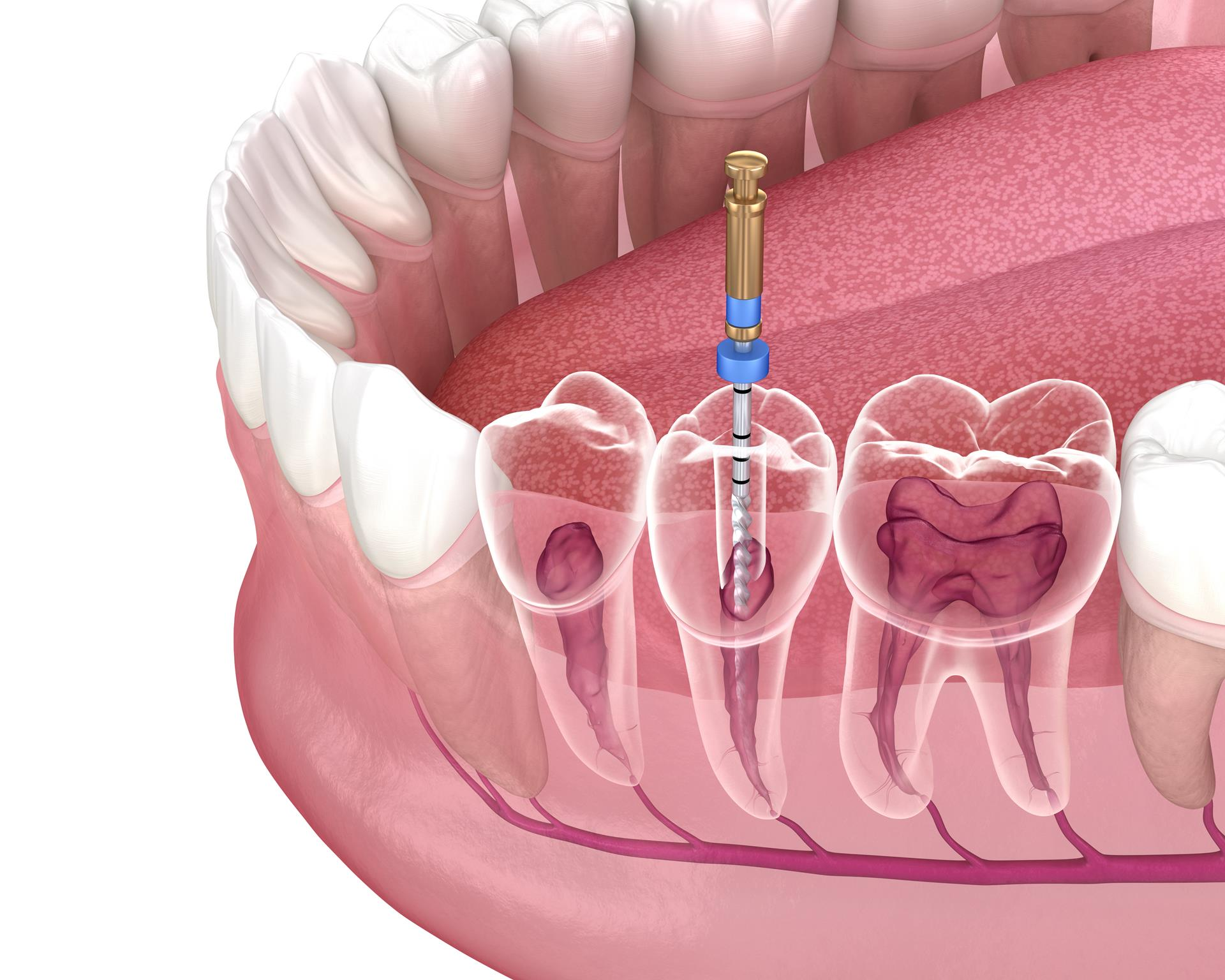 Endodontics